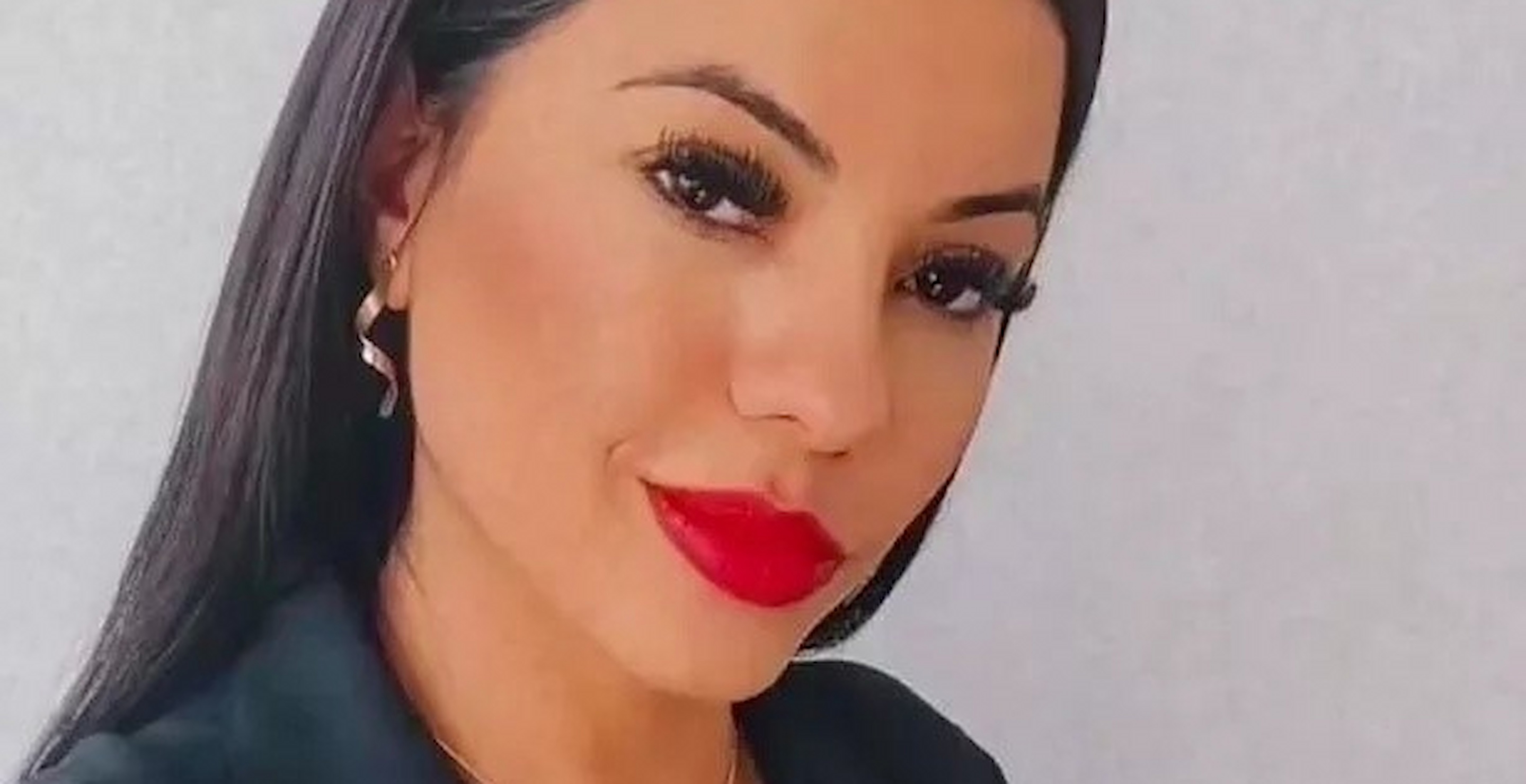 31-Year-Old Dies After Having Routine Cosmetic Surgery