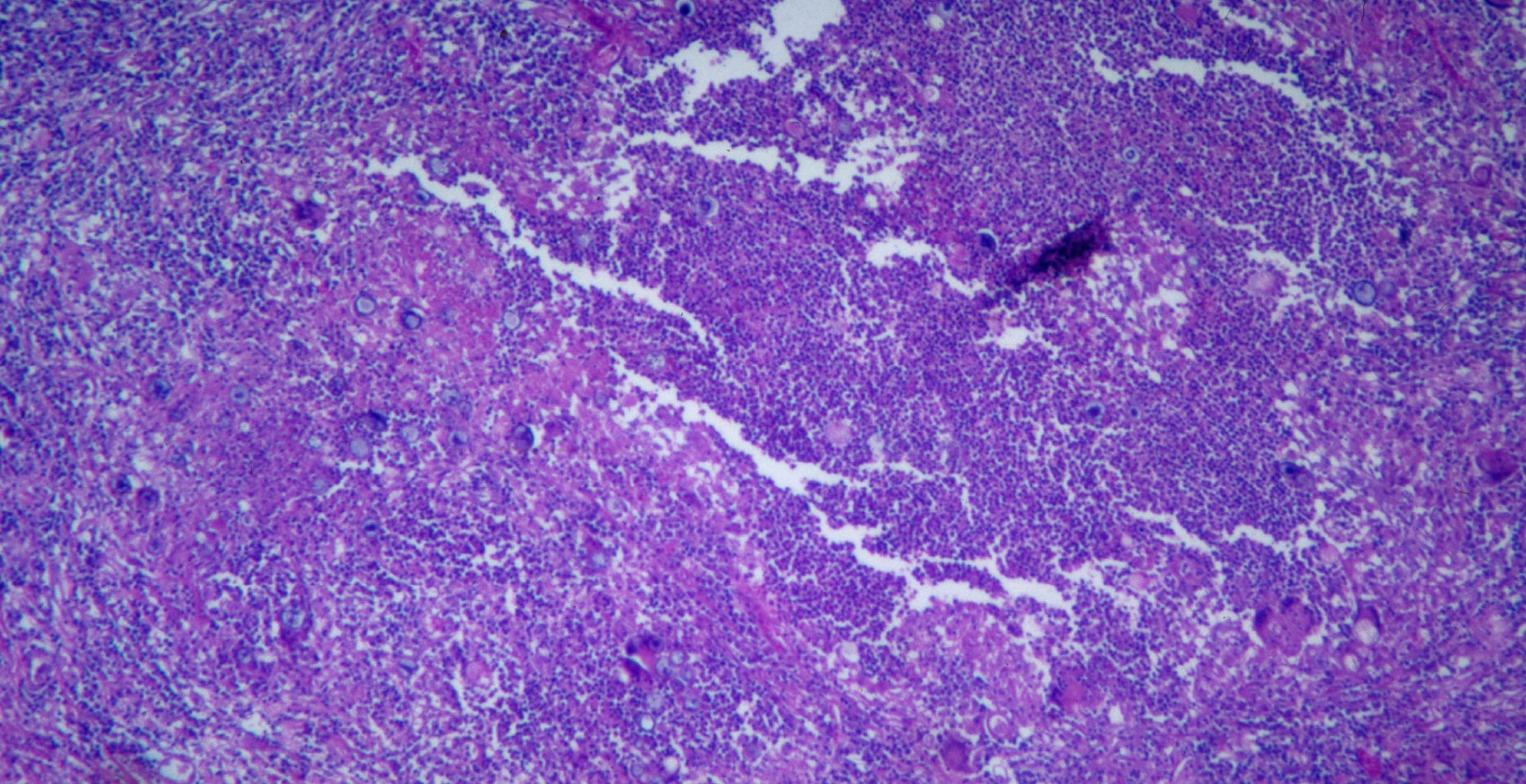 Valley Fever Fungus