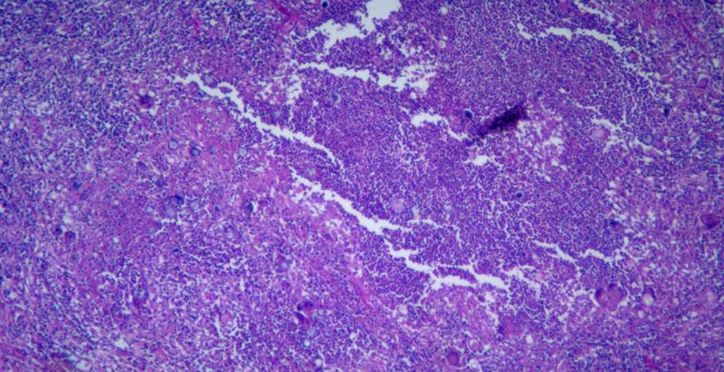 Valley Fever Fungus