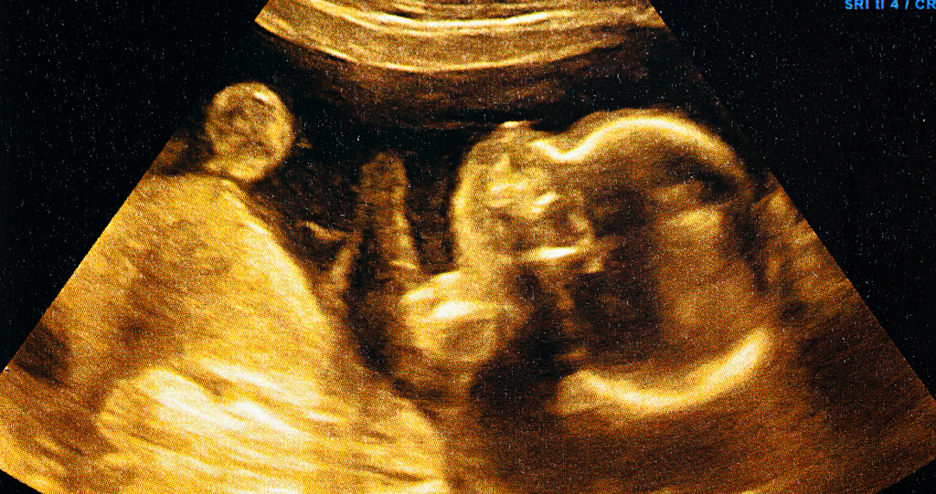love of beer starts in womb