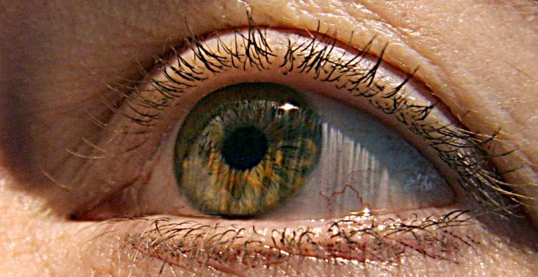Eye