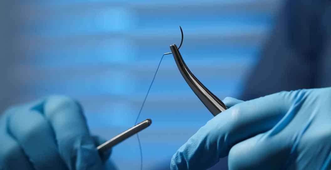 Forceps Surgery