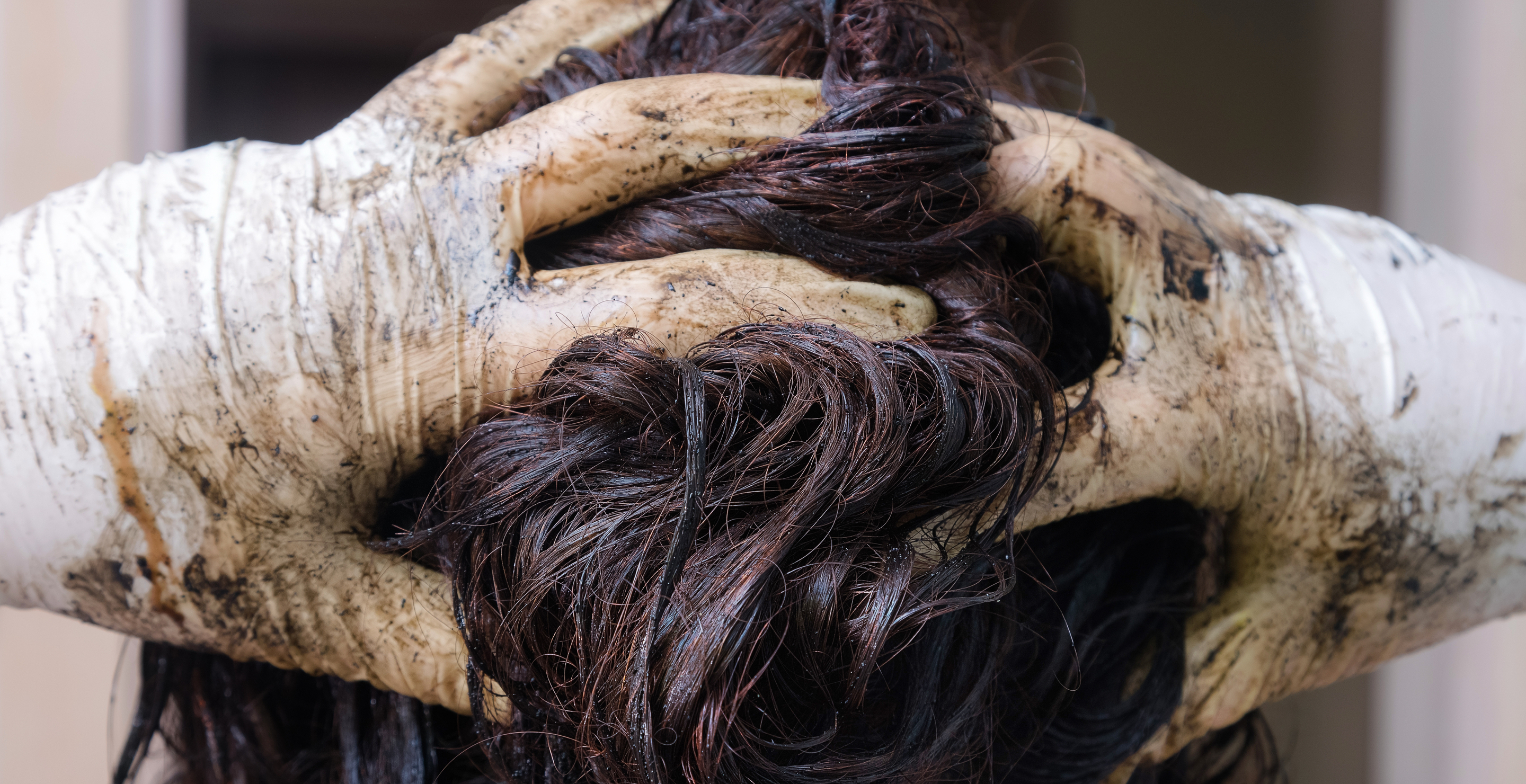 Model Sues Beauty Company After Claiming They Disfigured Her Head