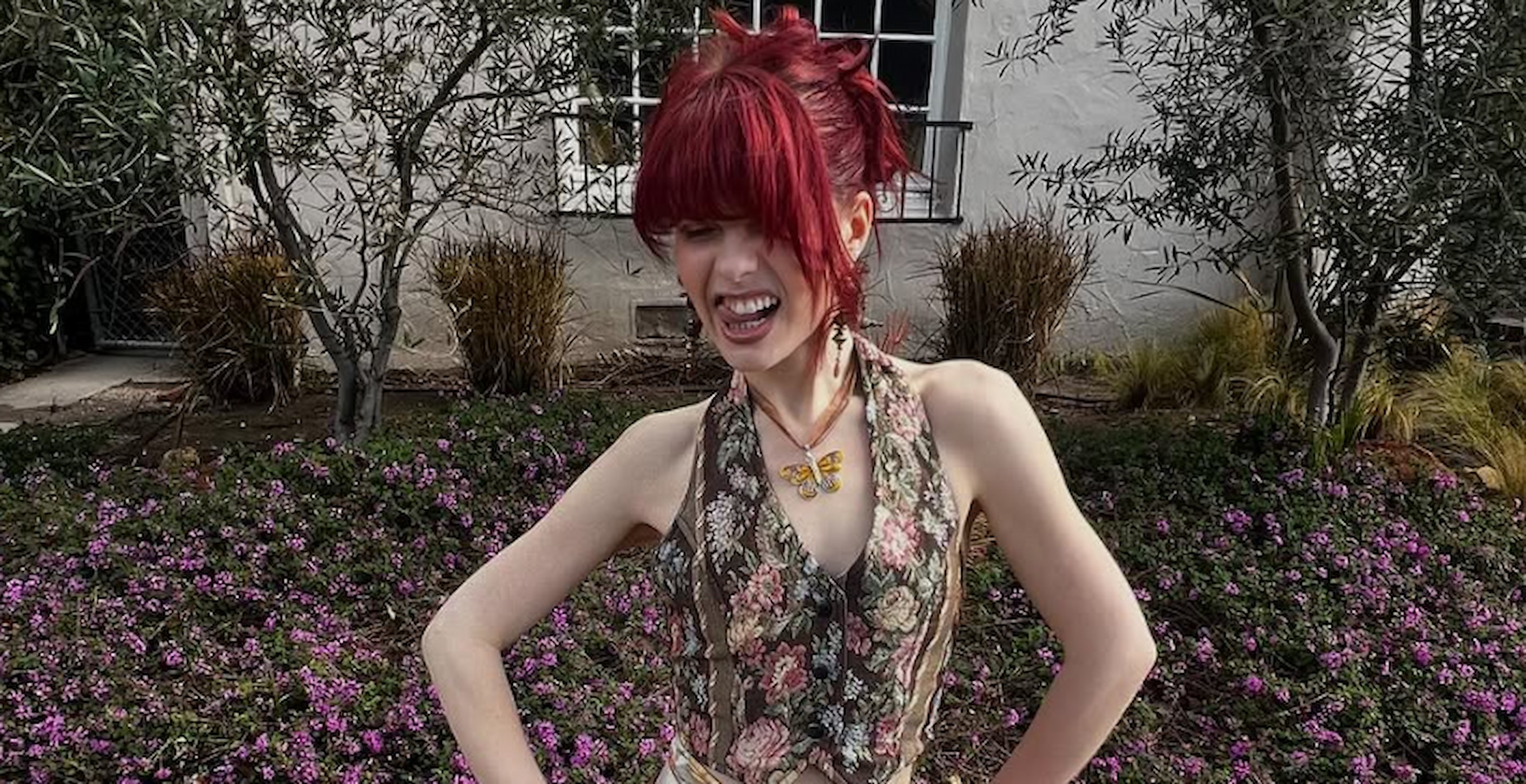'American Idol' Finalist Sparks Health Concerns After Recent Appearance