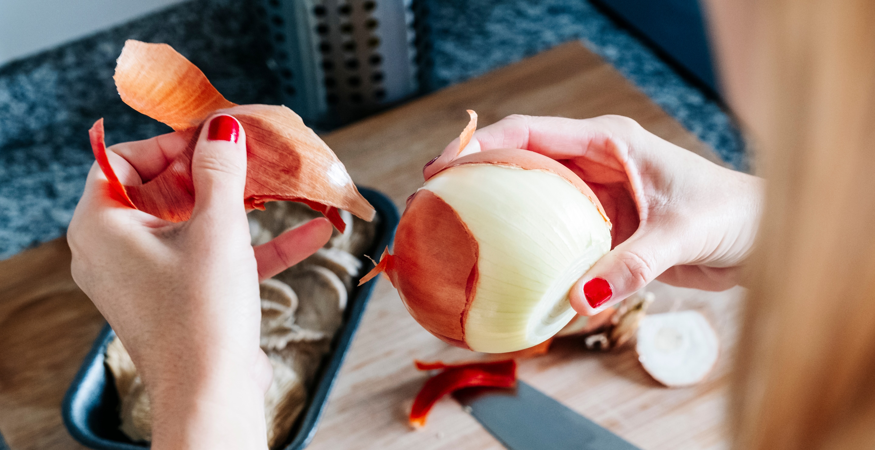 Woman Lands In The Emergency Room After Peeling Onions Goes Wrong