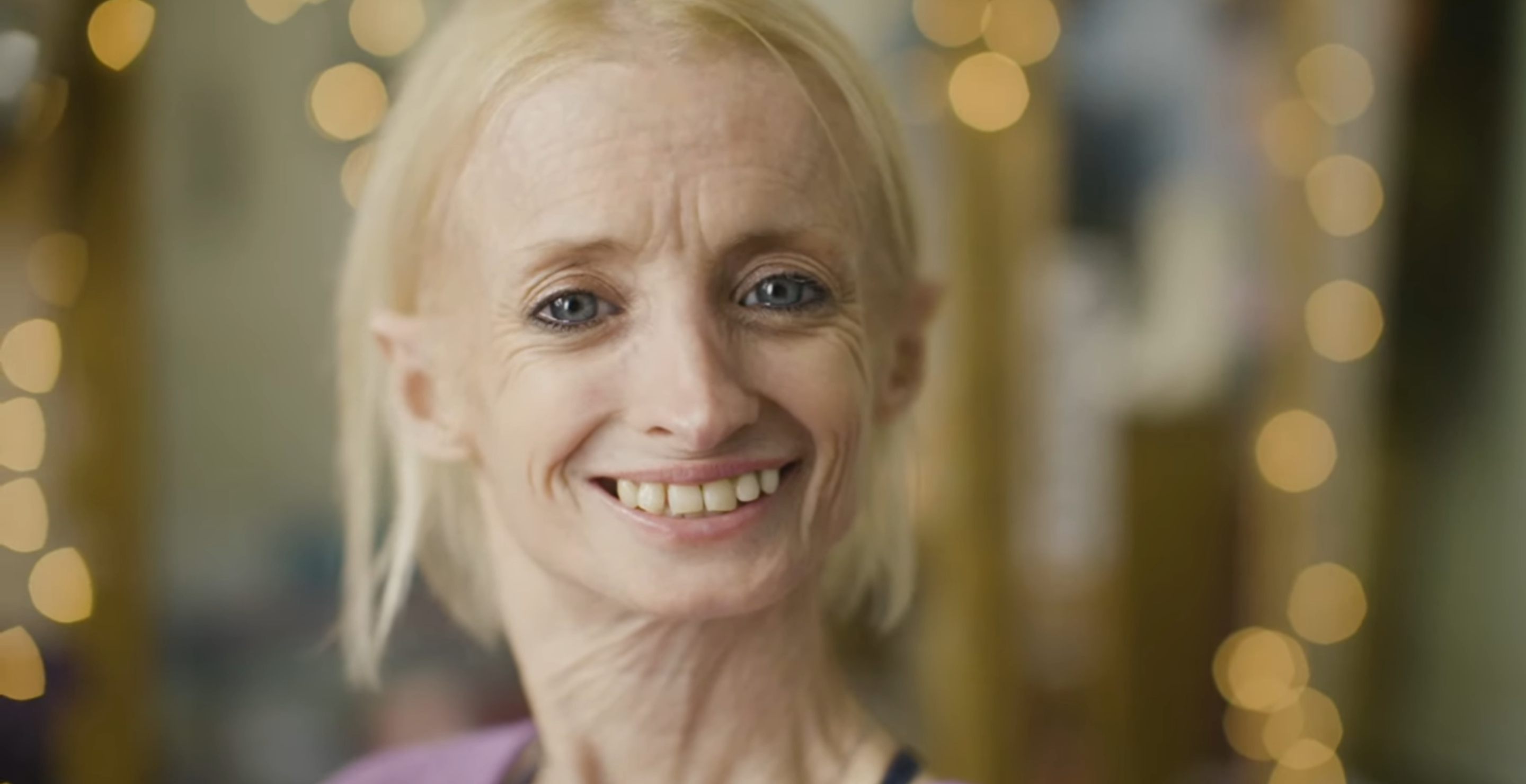 Woman Opens Up About Living With Rare Disease That Ages Her 8 Times Faster Than Normal
