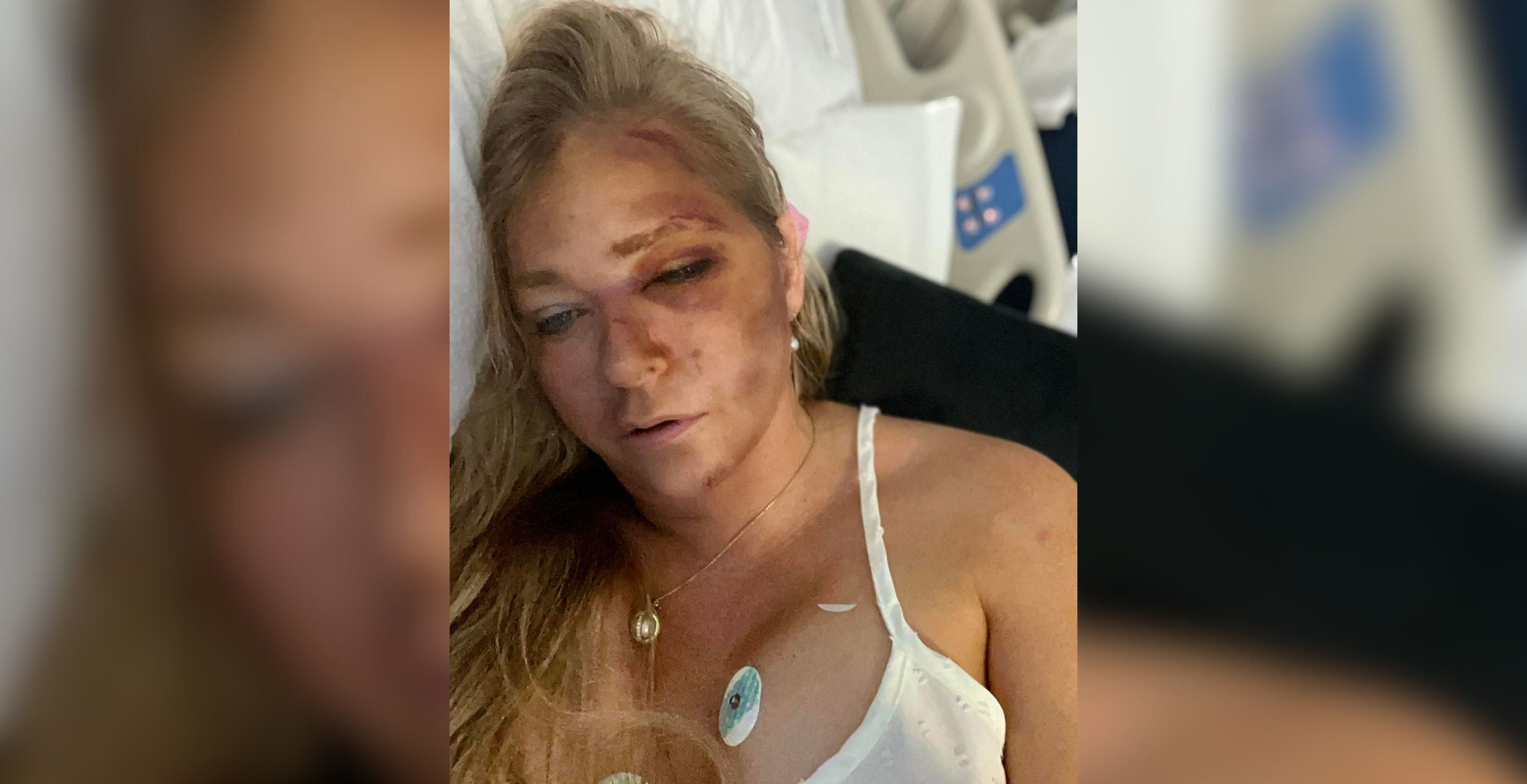 Epstein And Prince Andrew Accuser Claims To Have “4 Days To Live” After Car Crash