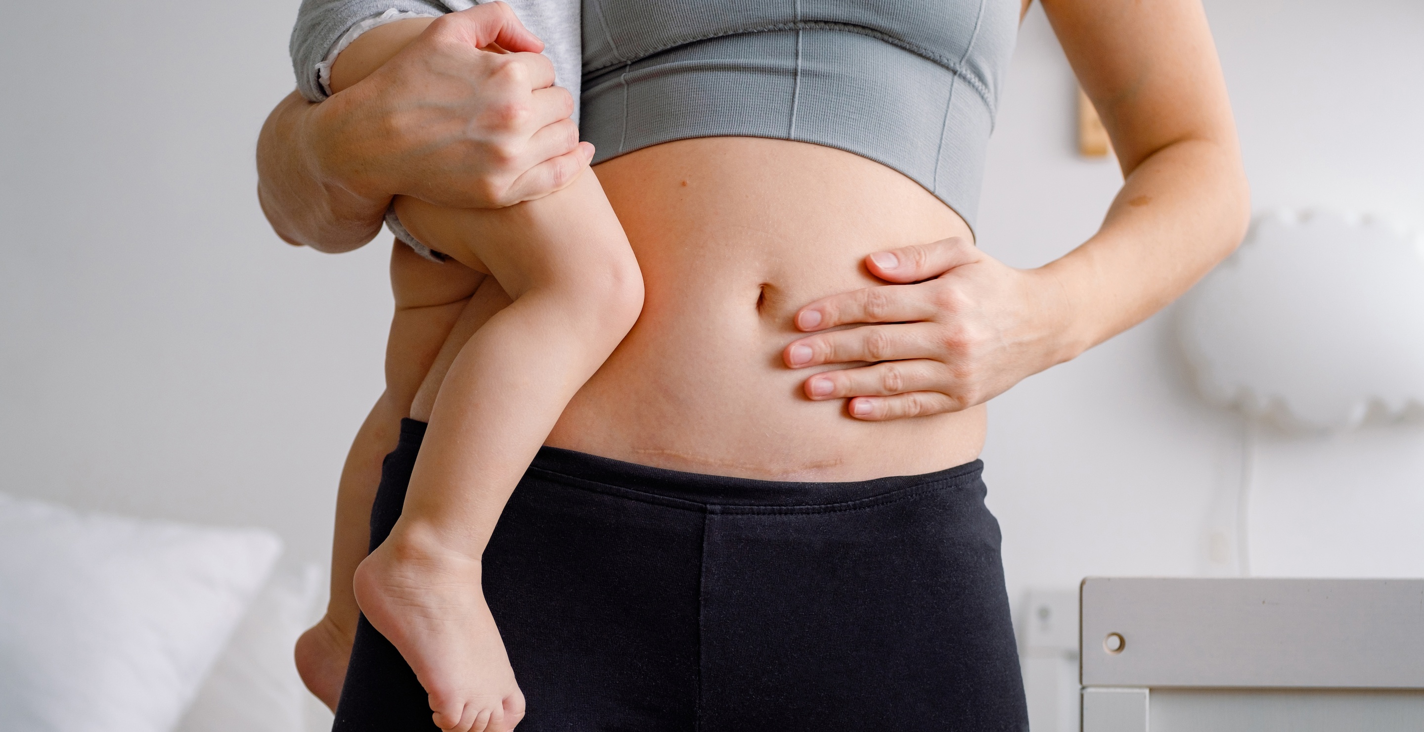 Doctors Remove Scissors Left In Woman’s Stomach During C-Section After 17 Years