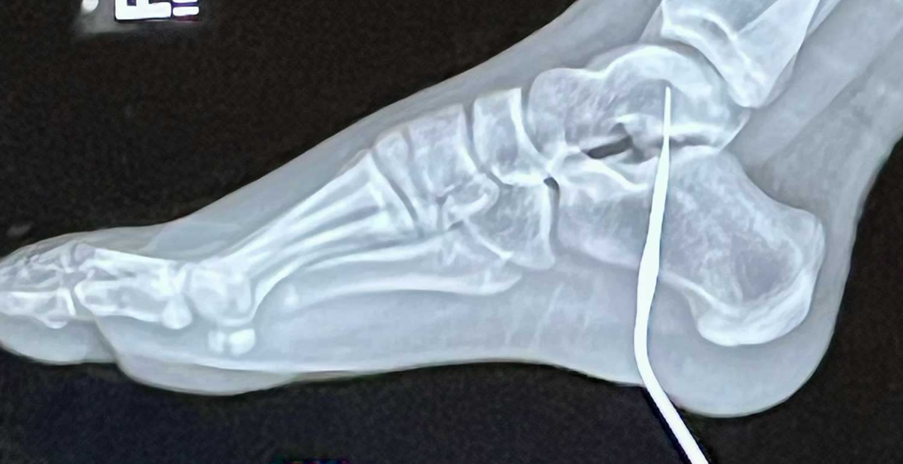 Foot, Needle, Georgia Sullivan