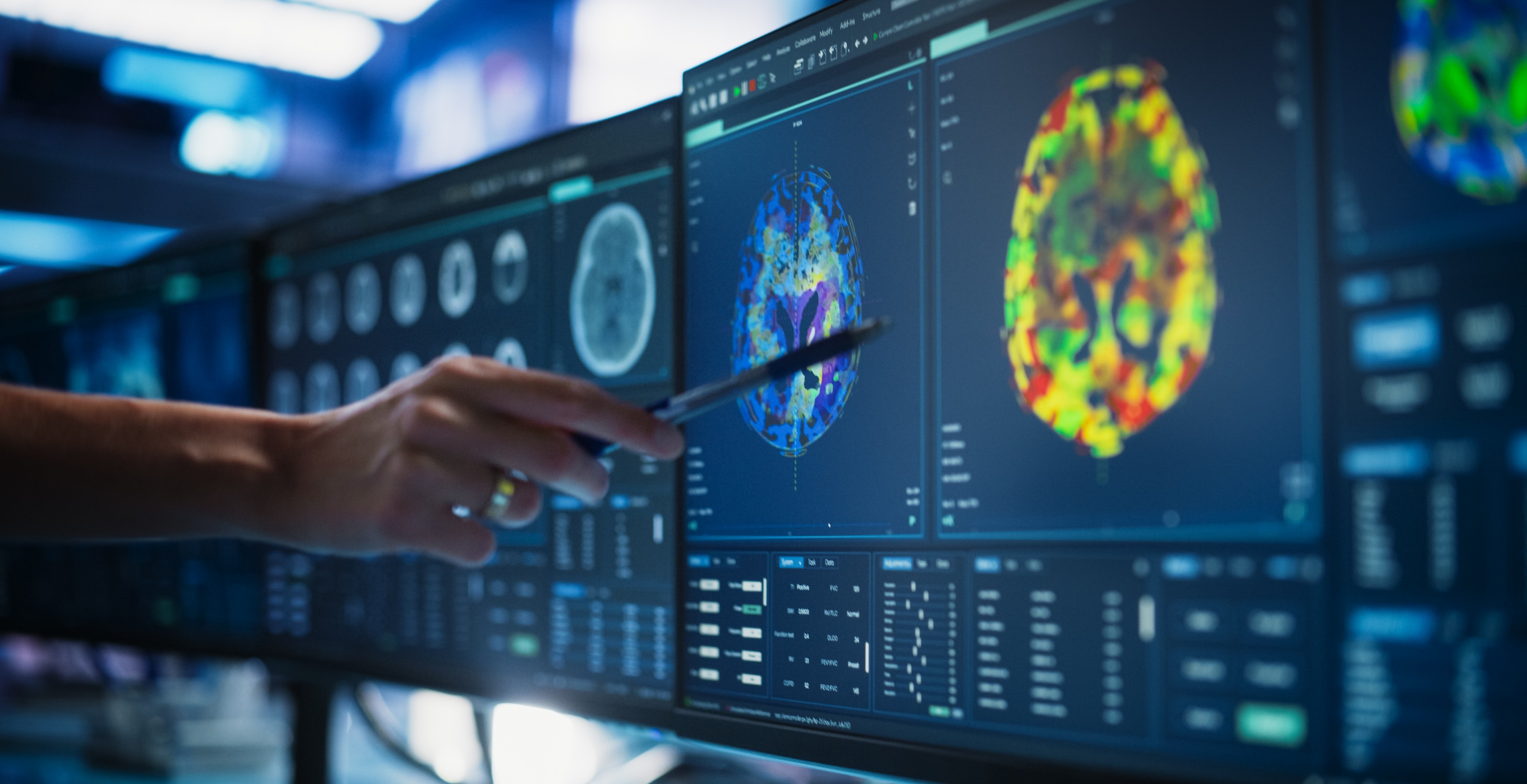 Sixth Brain Tumor Case Reported Among Massachusetts Hospital Staff Members